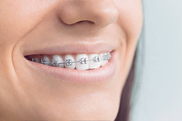 Best Invisalign and Clear Aligners  in Pea Ridge, FL